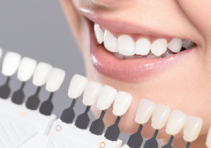 Dental_Excellence cosmetic dentist Adelaide
