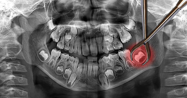 emergency dentist Adelaide