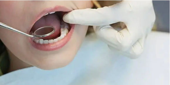 wisdom teeth removal Adelaide