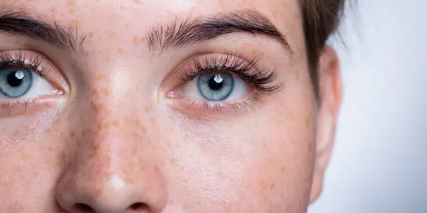 LASIK eye surgery